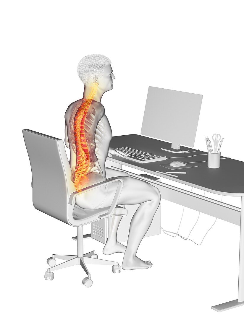 Office worker with back pain, conceptual illustration