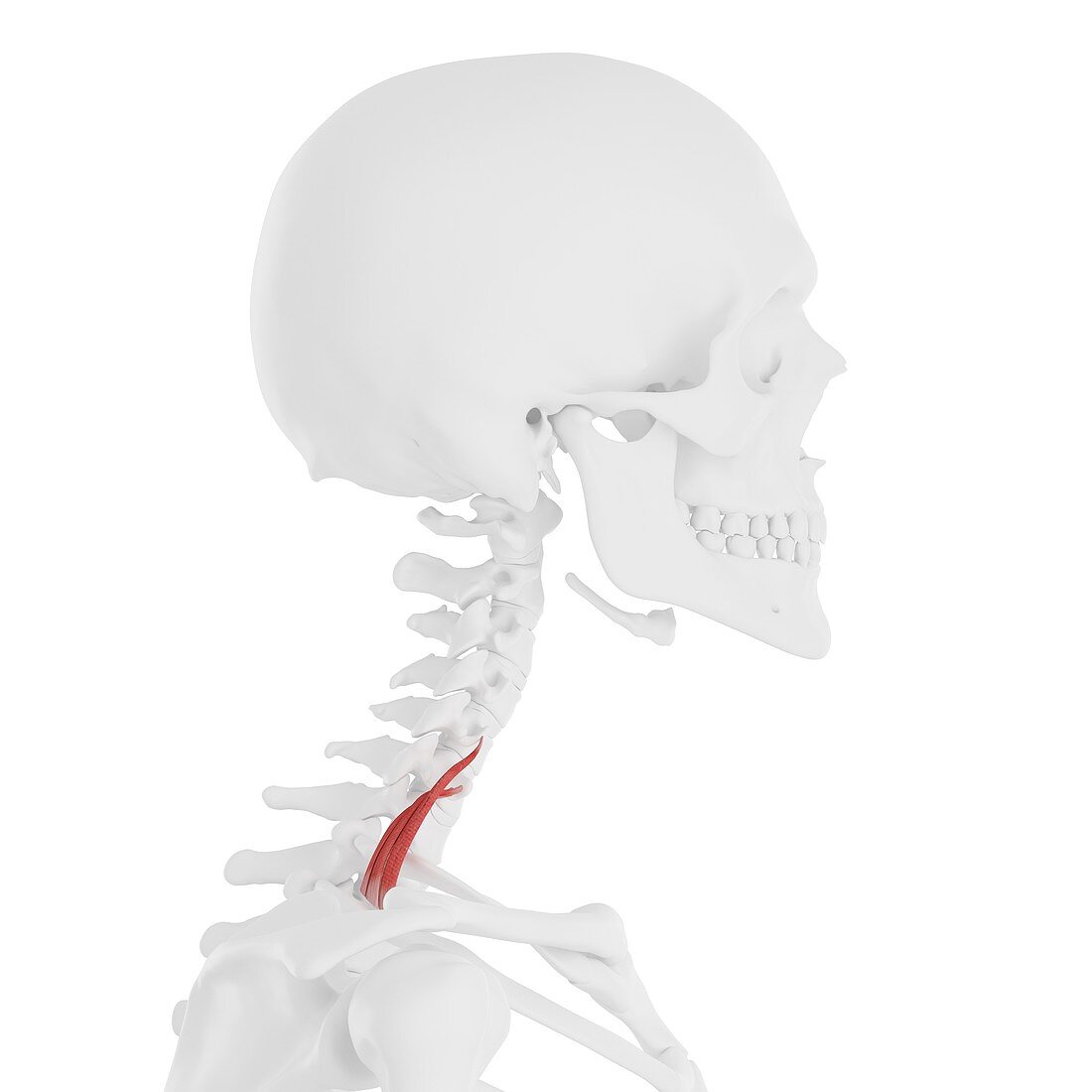 Scalene posterior muscle, illustration