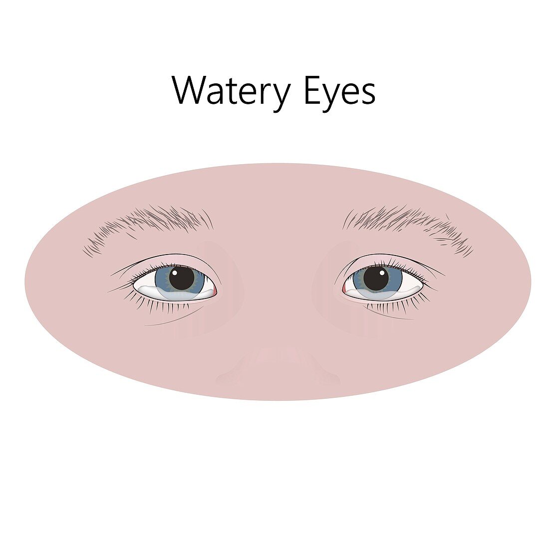 Watery eyes, illustration