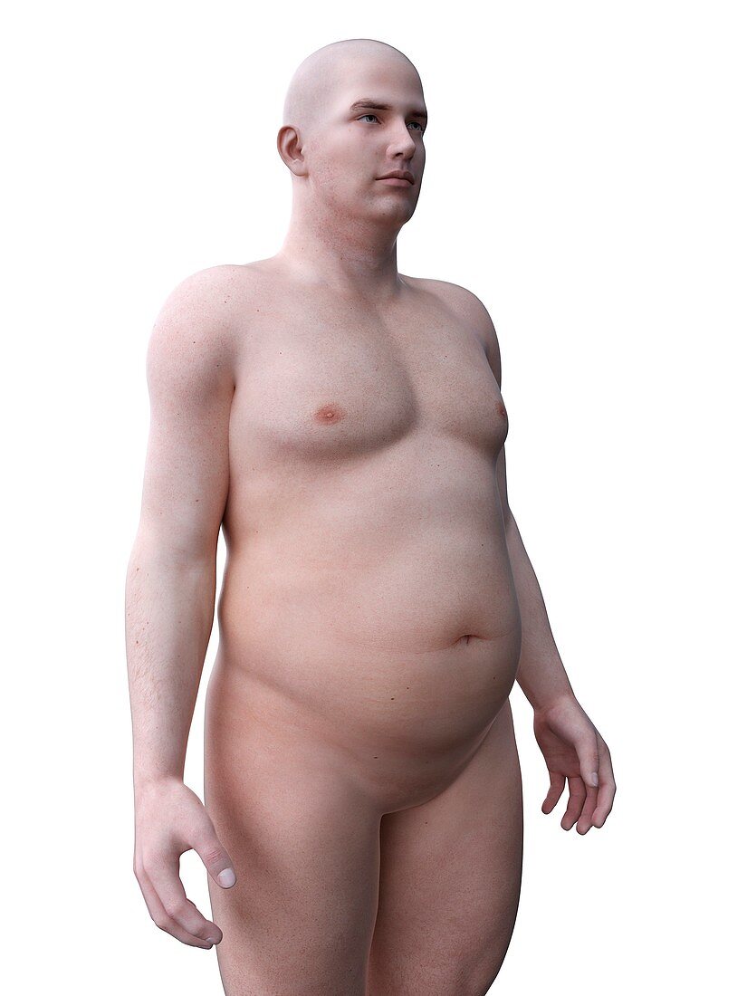 Obese man, illustration