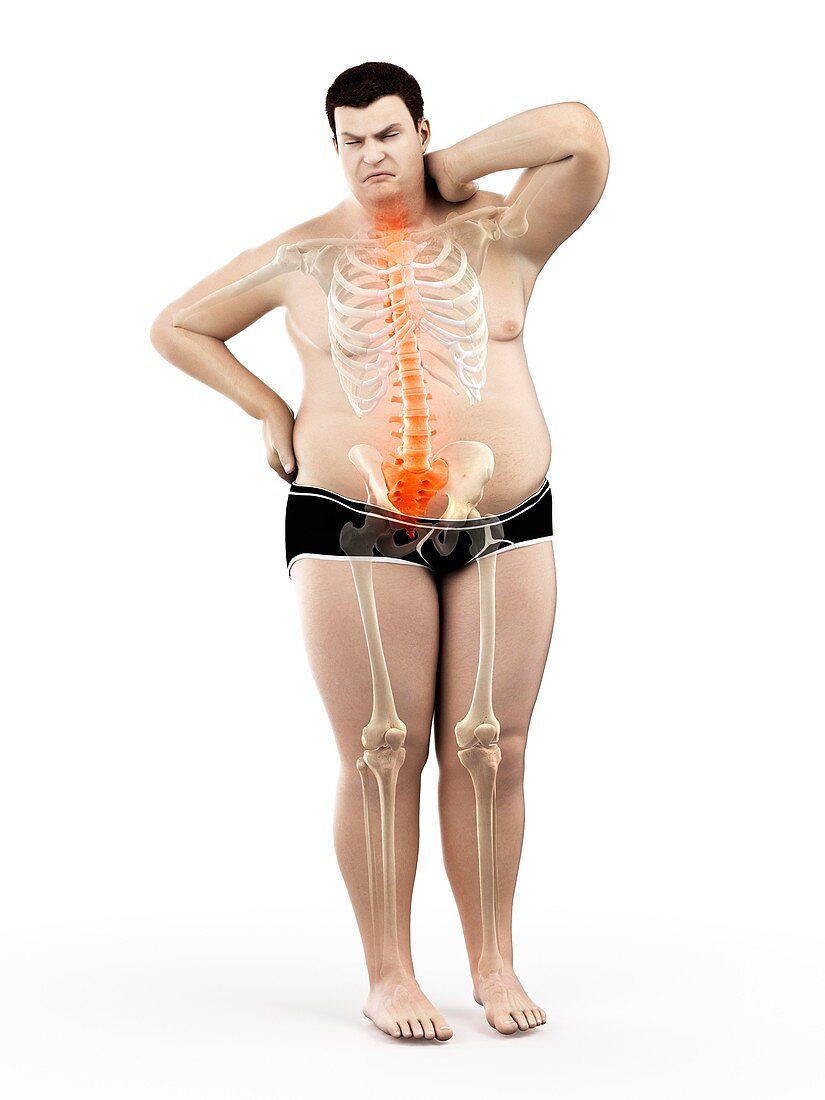 Obese man with back pain, illustration