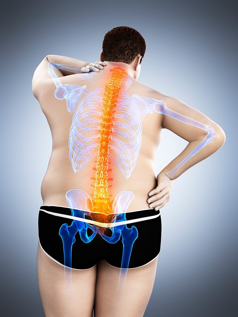 Obese man with back pain, illustration