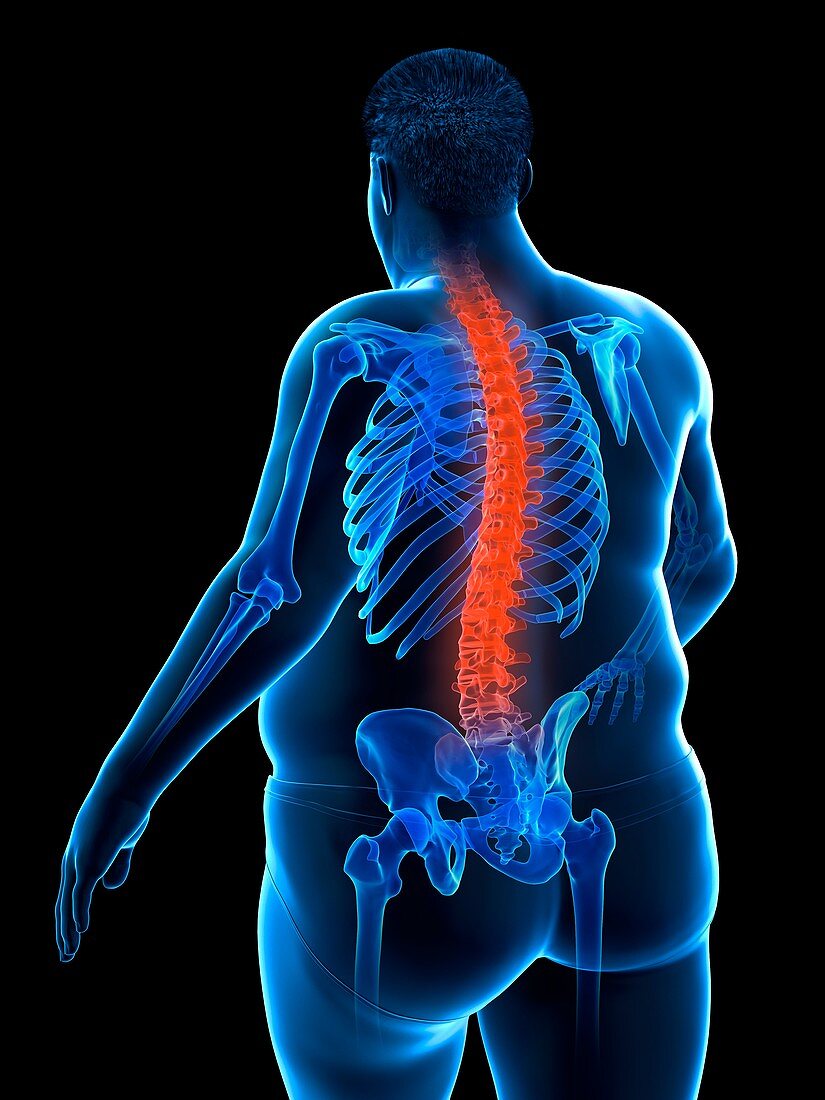 Obese man with back pain, illustration