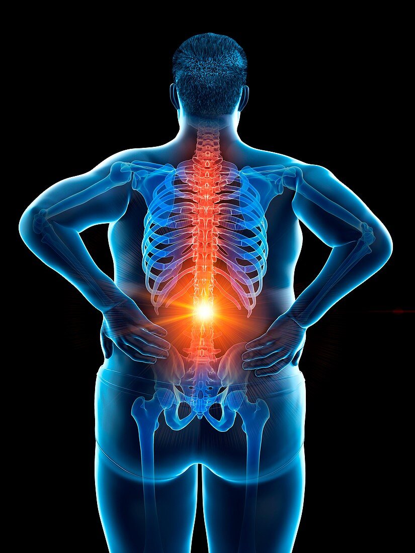 Obese man with back pain, illustration