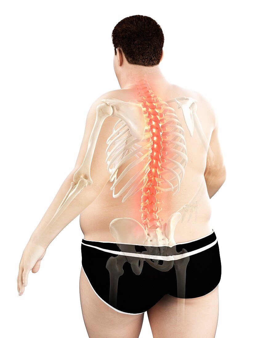 Obese man with back pain, illustration