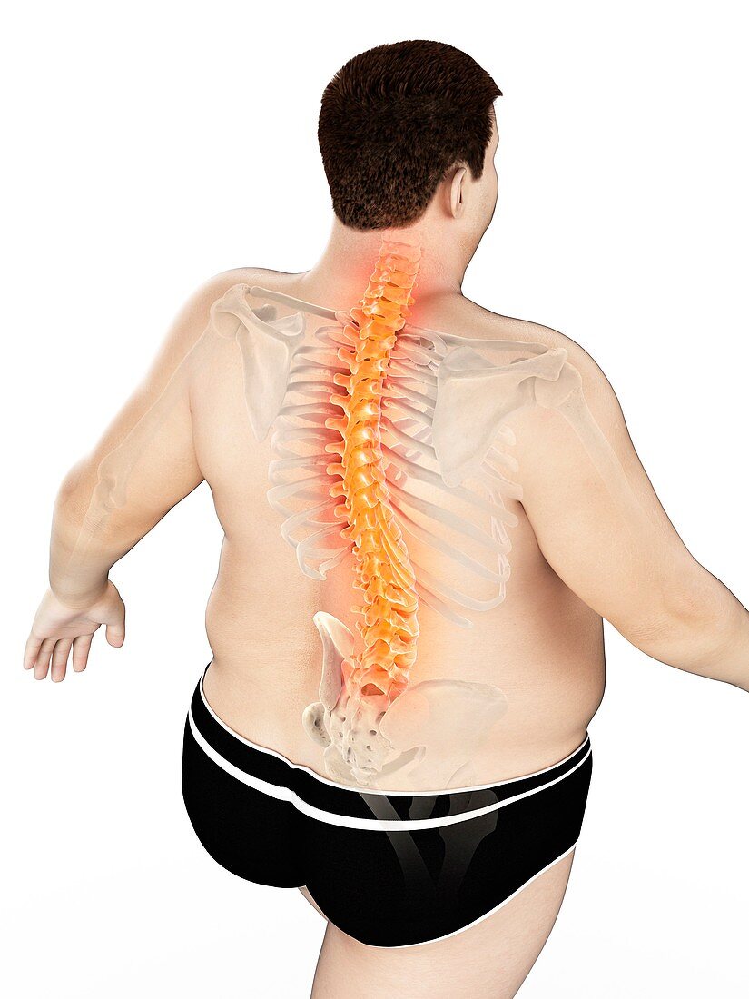 Obese man with back pain, illustration