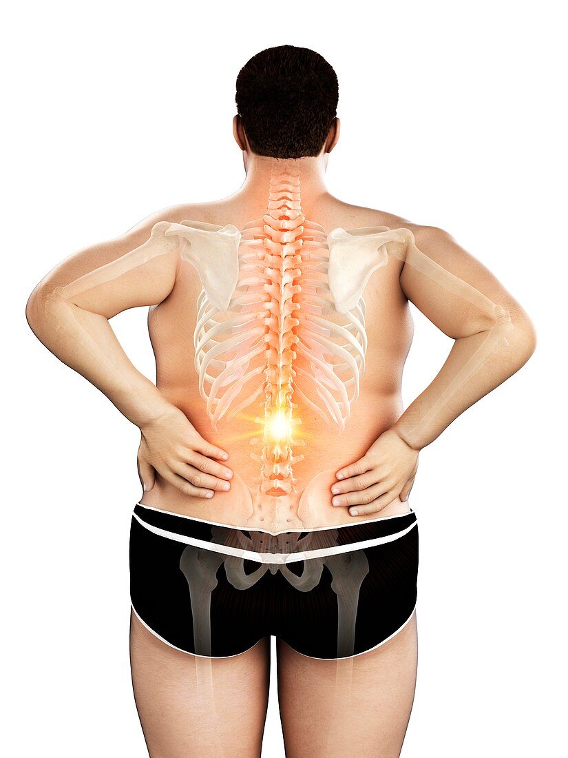 Obese man with back pain, illustration