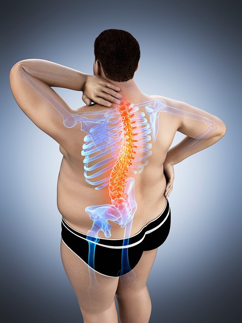 Obese man with back pain, illustration