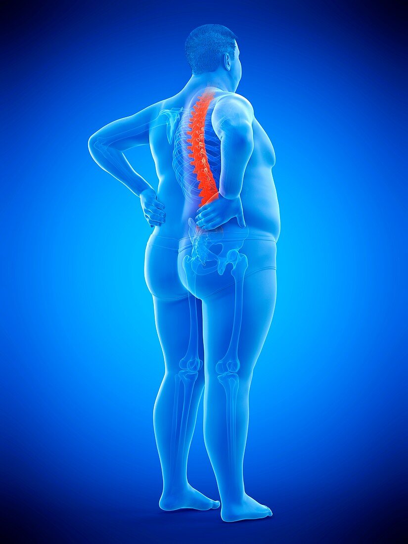 Obese man with back pain, illustration