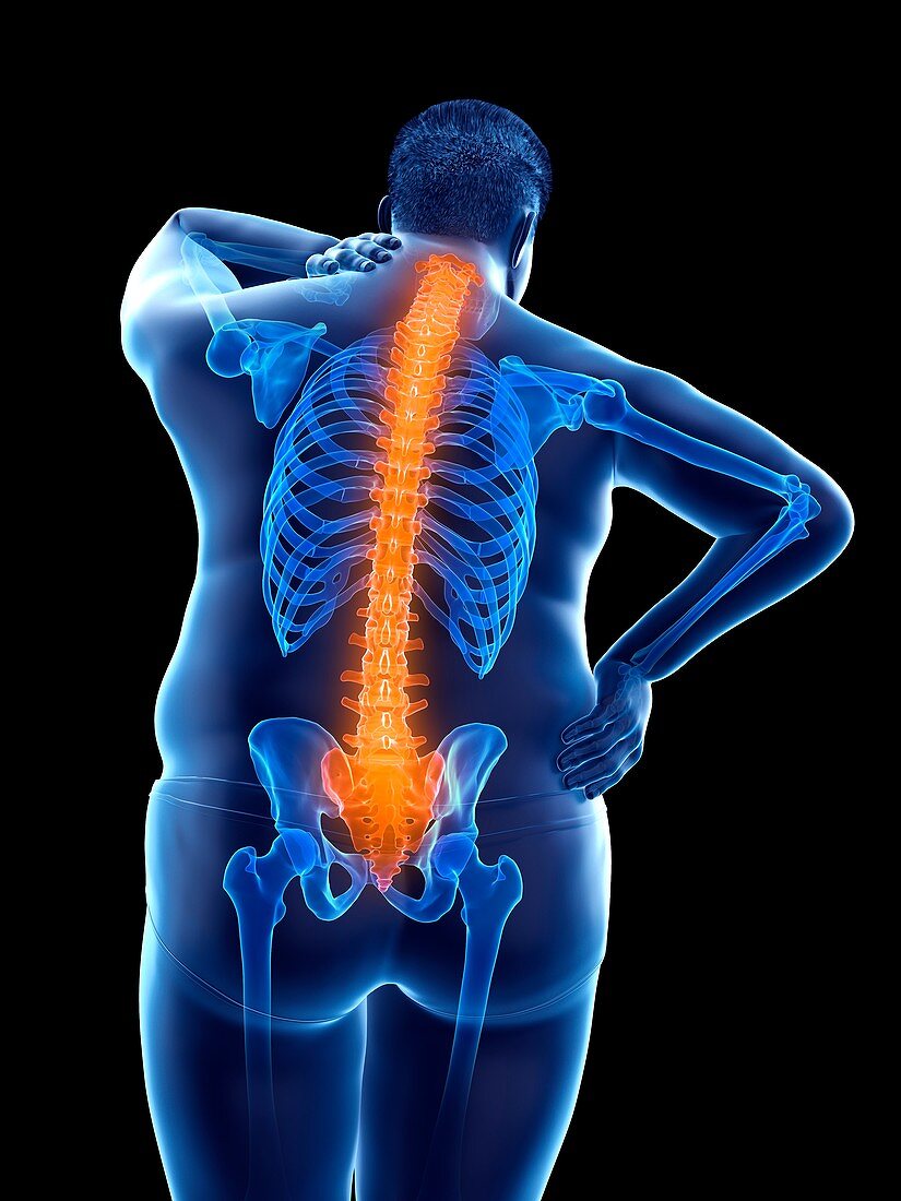 Obese man with back pain, illustration