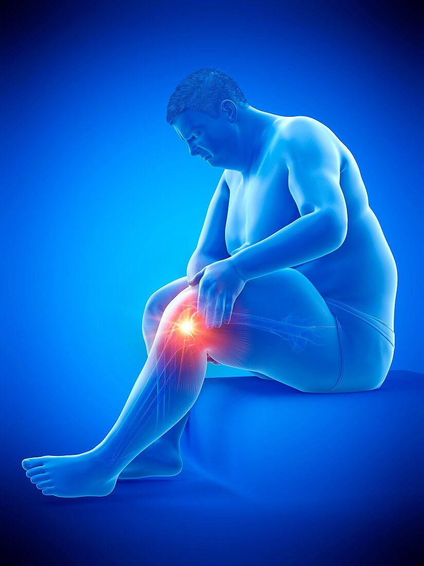 Obese man with knee pain, illustration