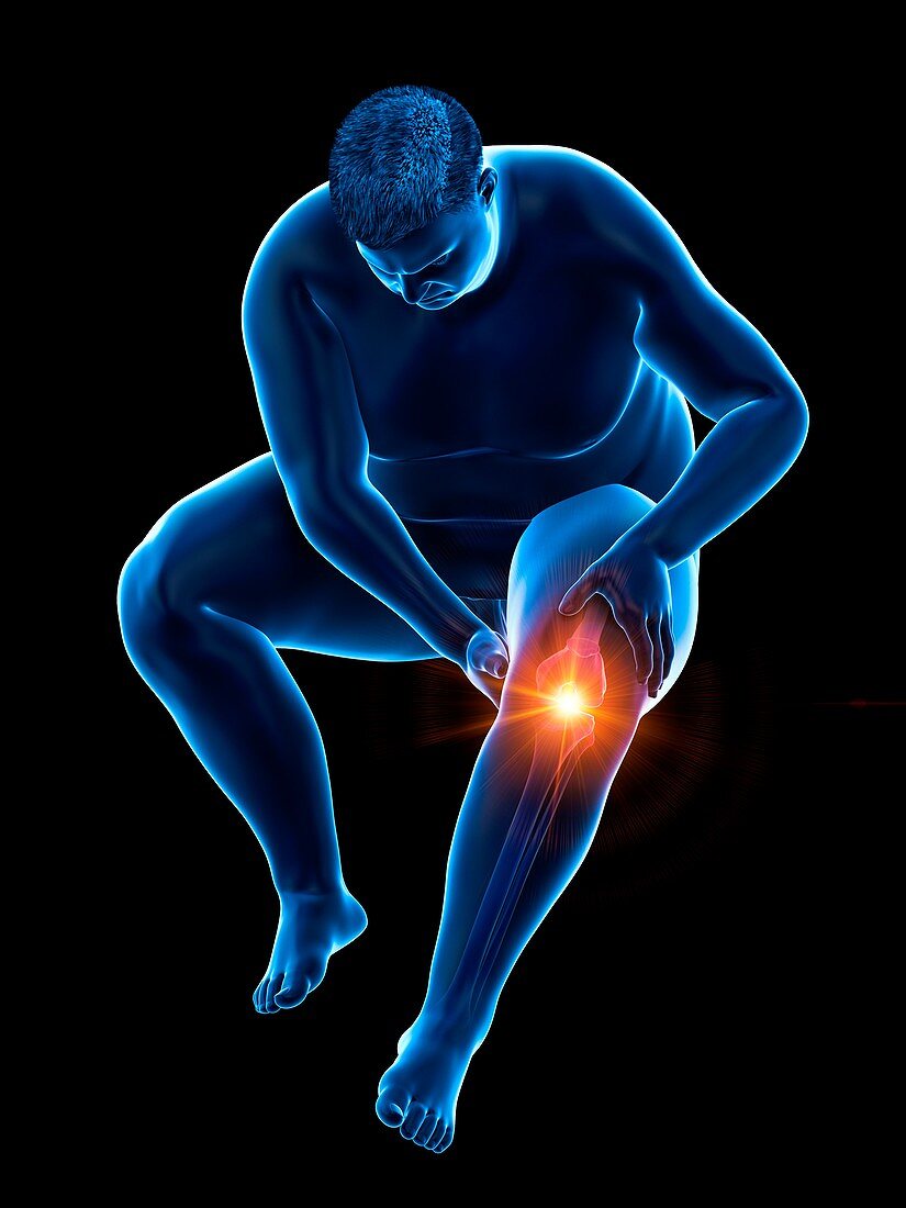 Obese man with knee pain, illustration