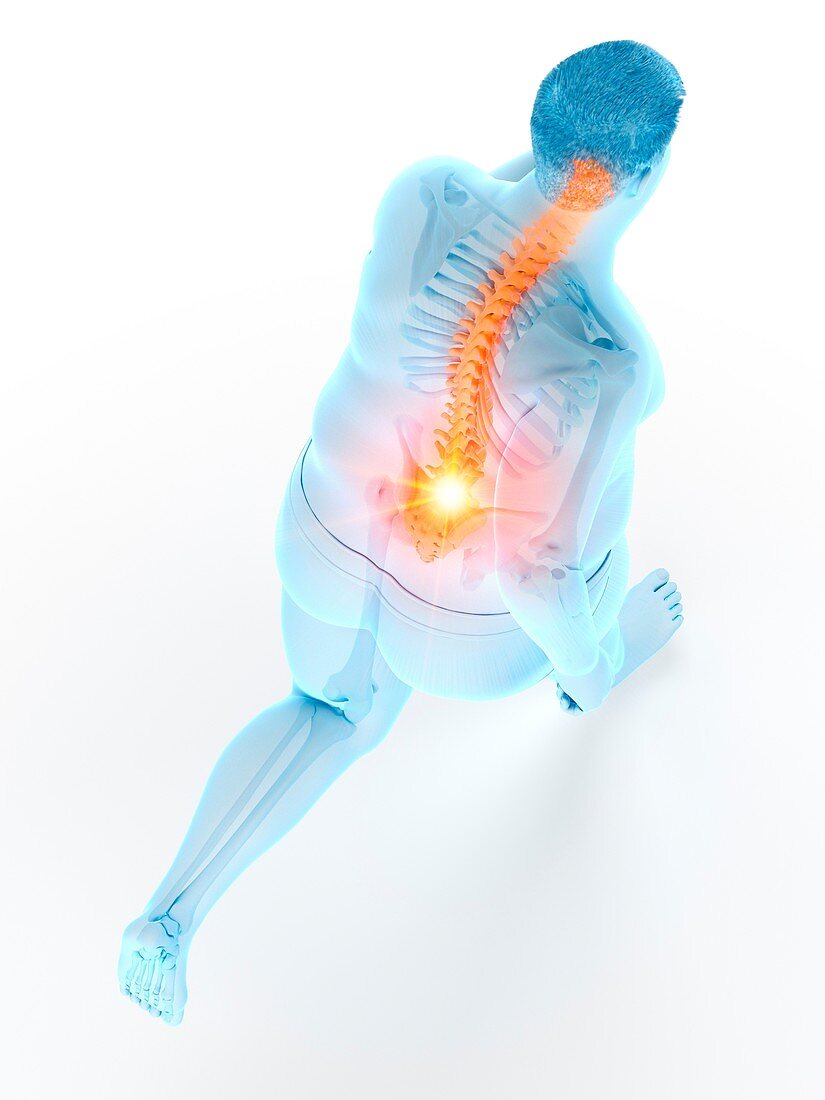 Obese runner with back pain, illustration