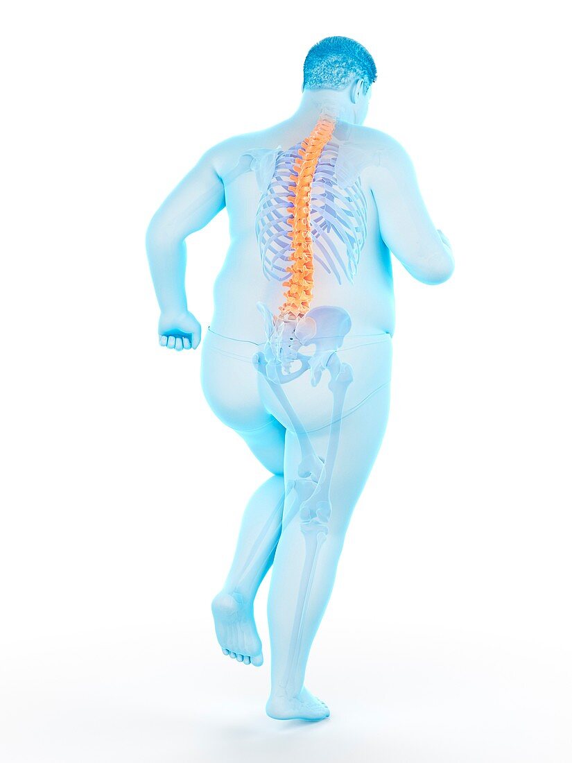 Obese runner with back pain, illustration