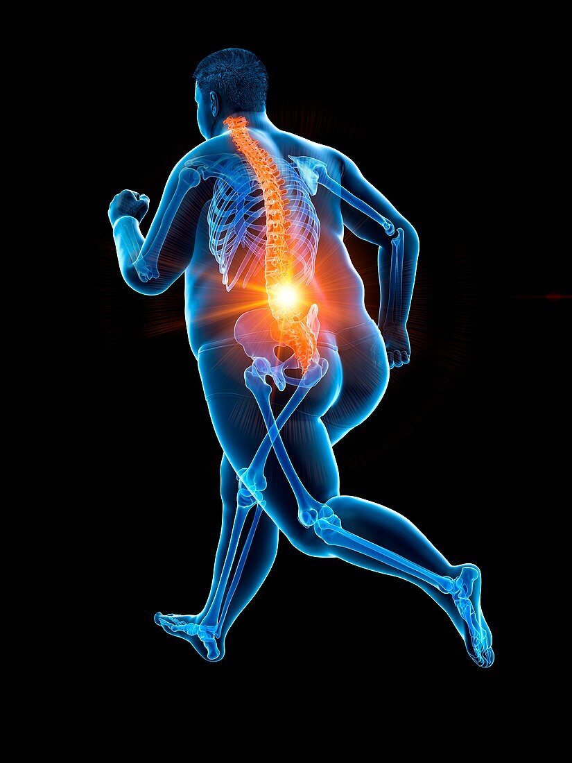 Obese runner with back pain, illustration