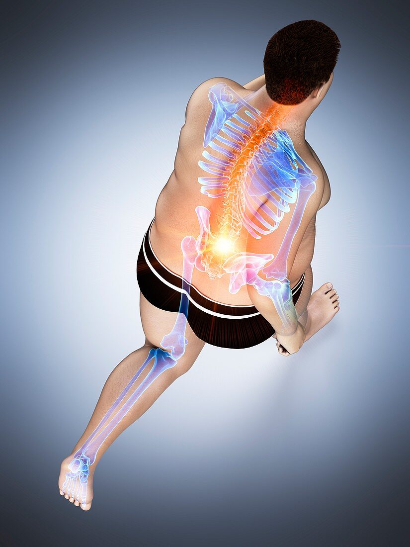 Obese runner with back pain, illustration