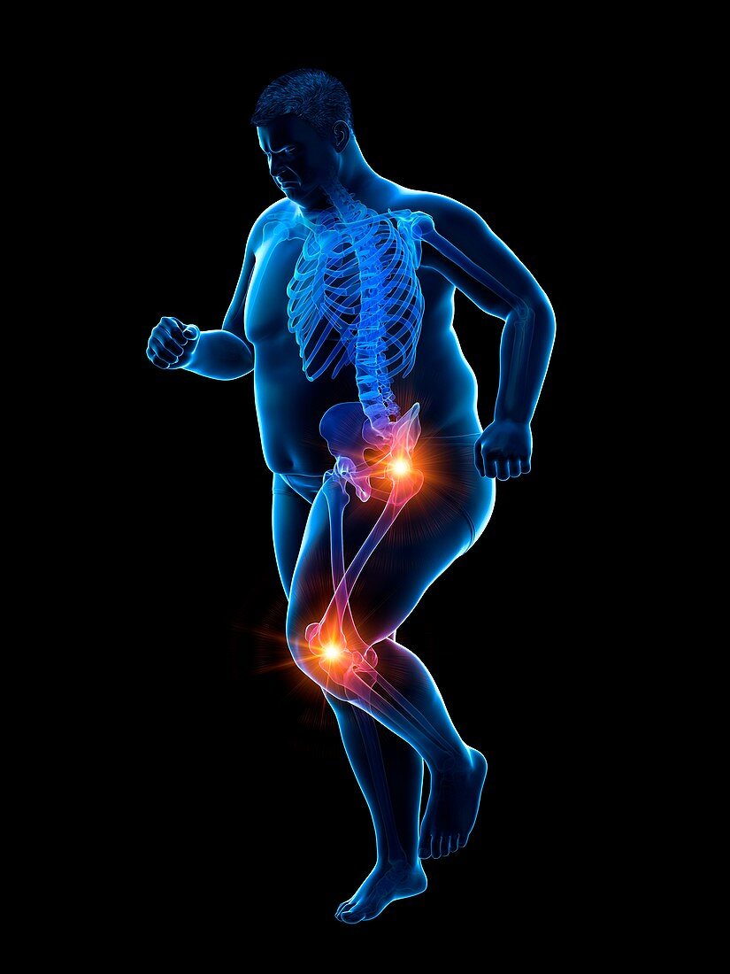 Obese runner with joint pain, illustration