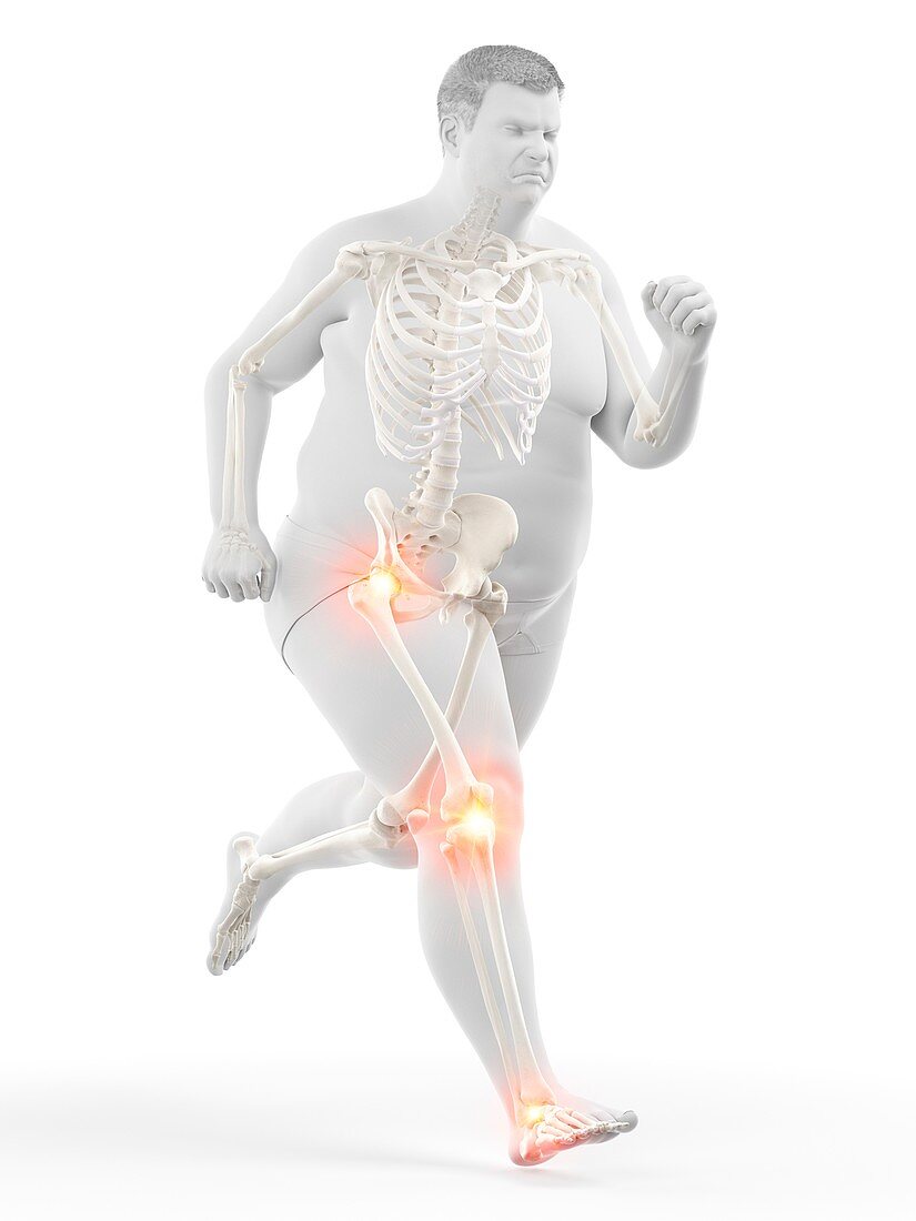 Obese runner with joint pain, illustration