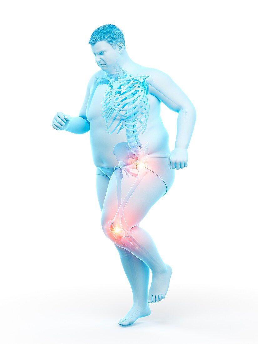 Obese runner with joint pain, illustration