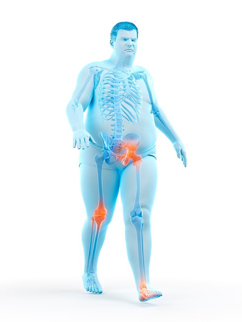 Obese runner with joint pain, illustration