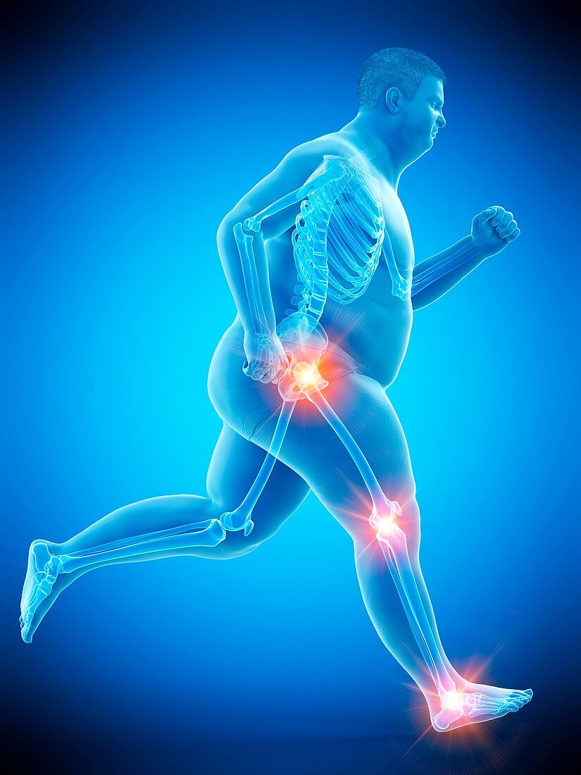 Obese runner with joint pain, illustration