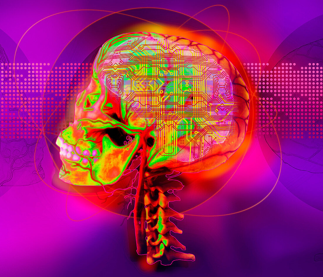 X-ray of human skull and microchip, illustration