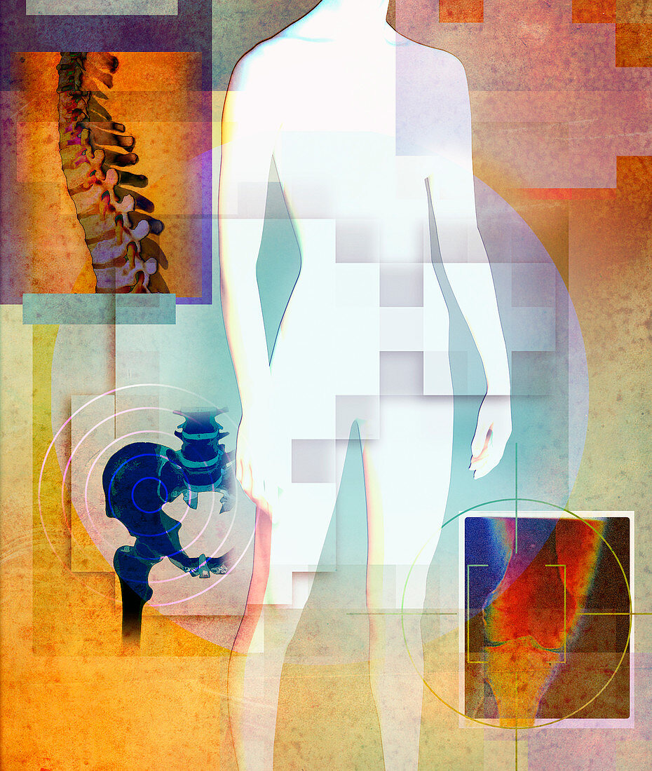Woman's body with spine, hip and knee bones, illustration
