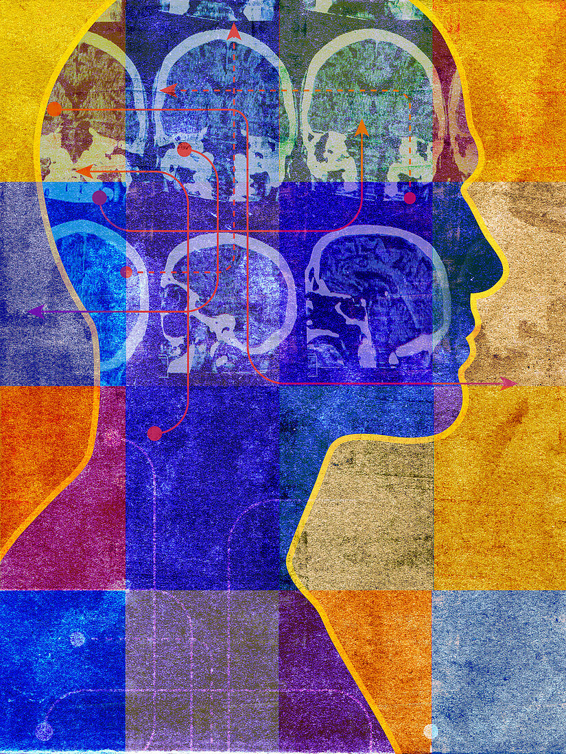 Brain scans inside of profile on man's head, illustration