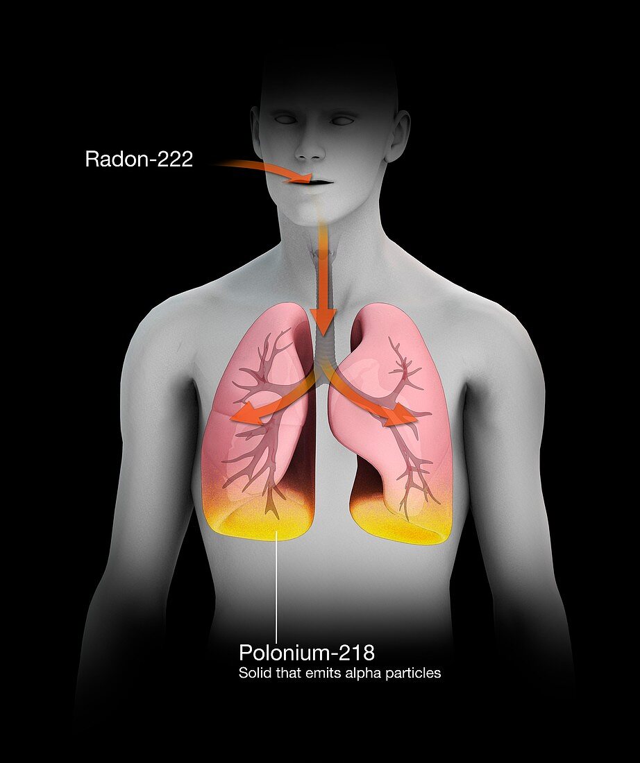 Radon decaying to polonium in humans, illustration