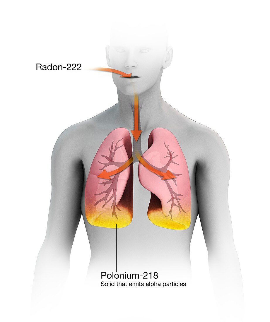 Radon decaying to polonium in humans, illustration