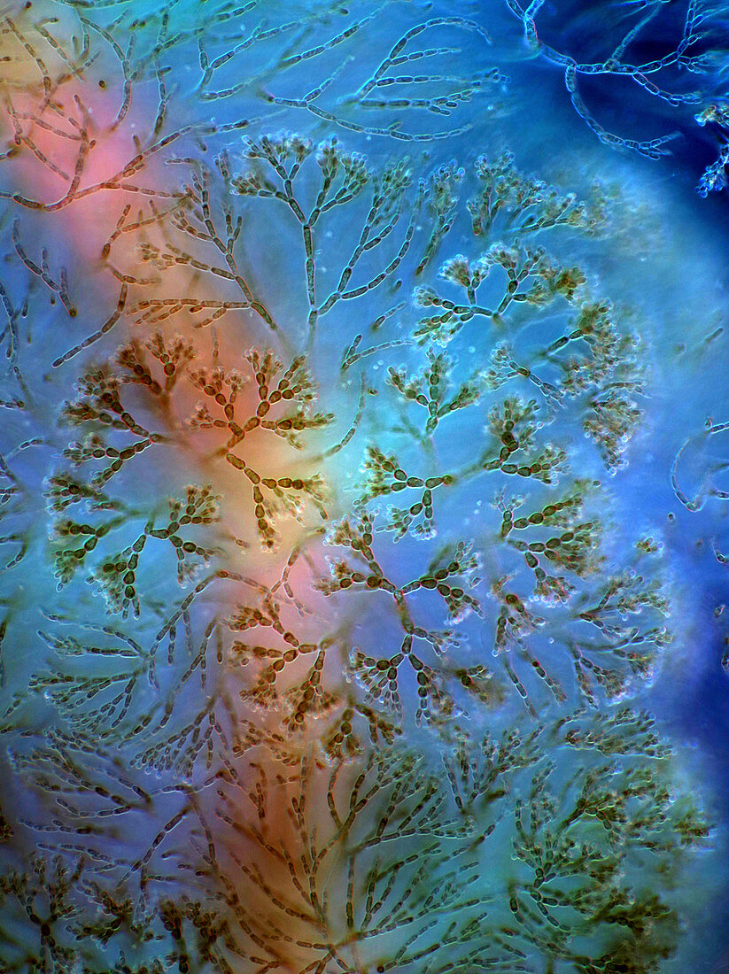 Batrachospermum red algae, light micrograph
