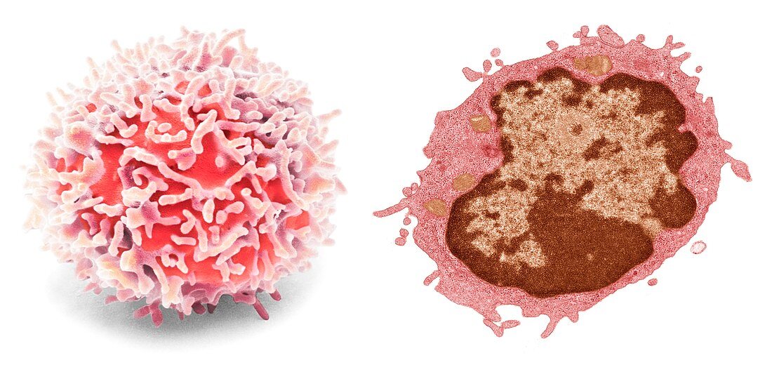 Lymphocyte, SEM-TEM comparison