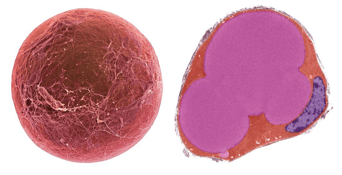 Fat cell, SEM-TEM comparison