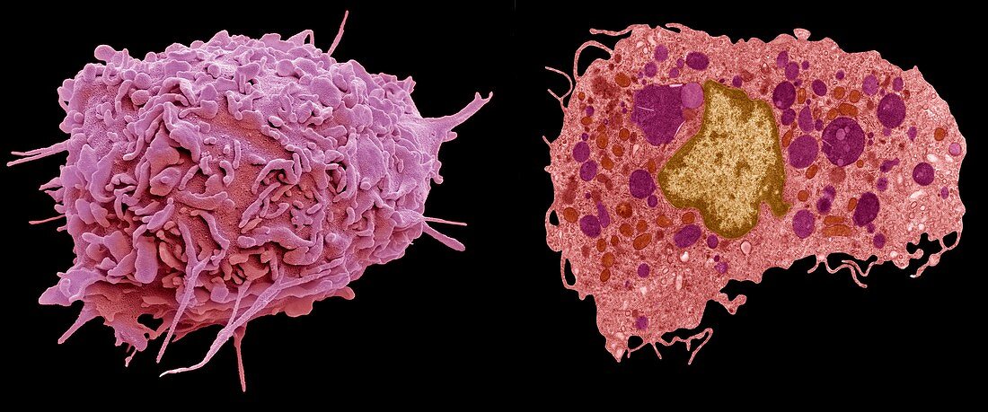 Macrophage, SEM-TEM comparison