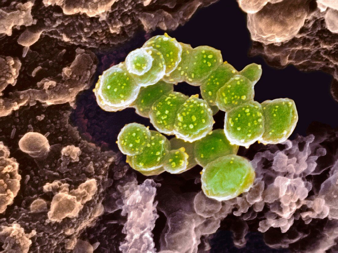 Chikungunya virus-infected cells, SEM