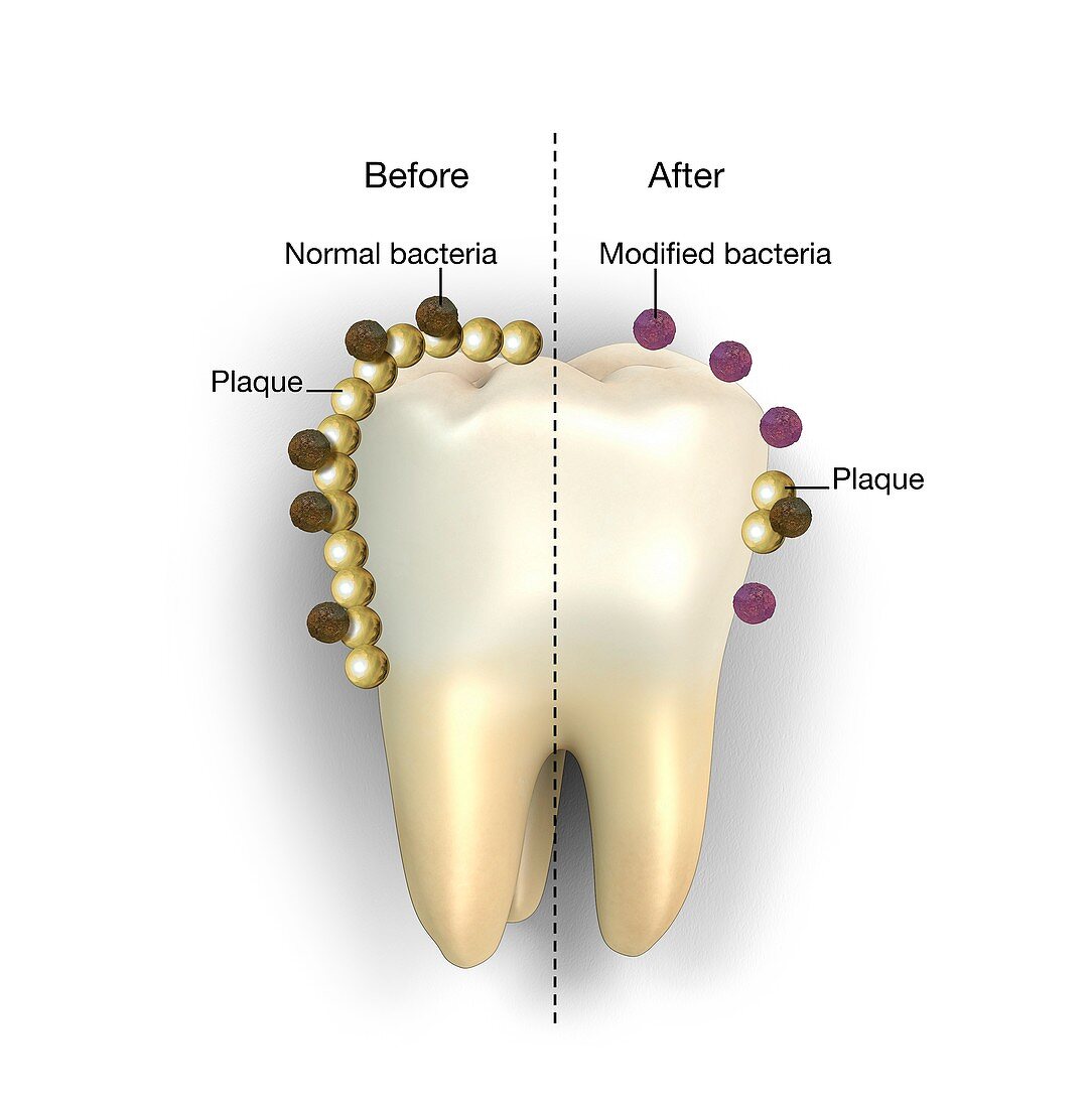 Genetic modification of dental bacteria, illustration