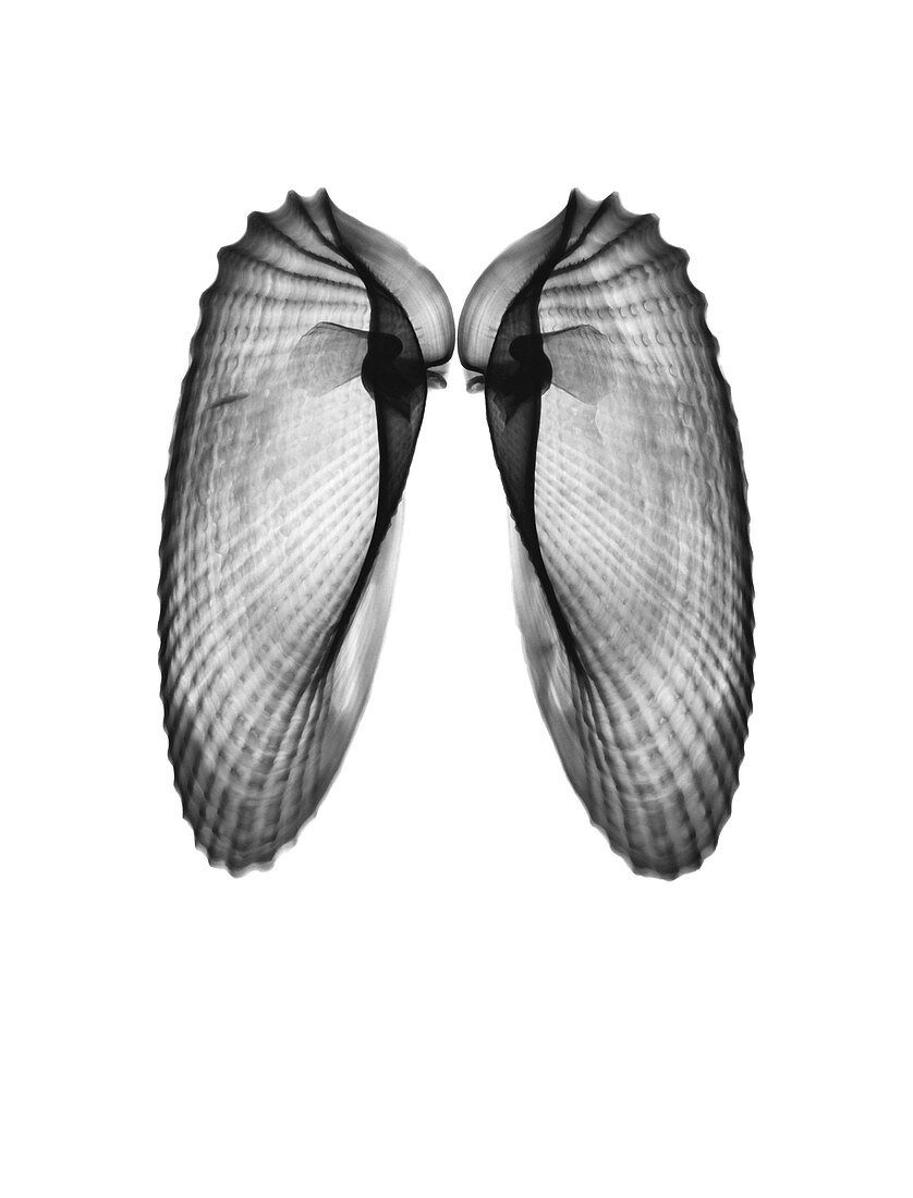 Angel wing clam shells, X-ray