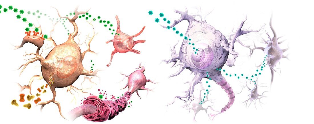 HERV and autoimmune neural diseases, illustration