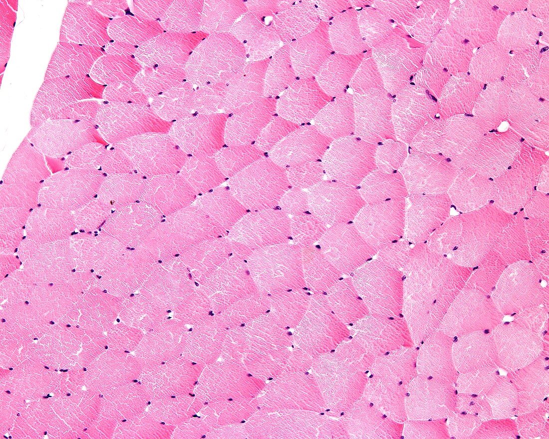 Cross-sectioned skeletal muscle fibres, light micrograph