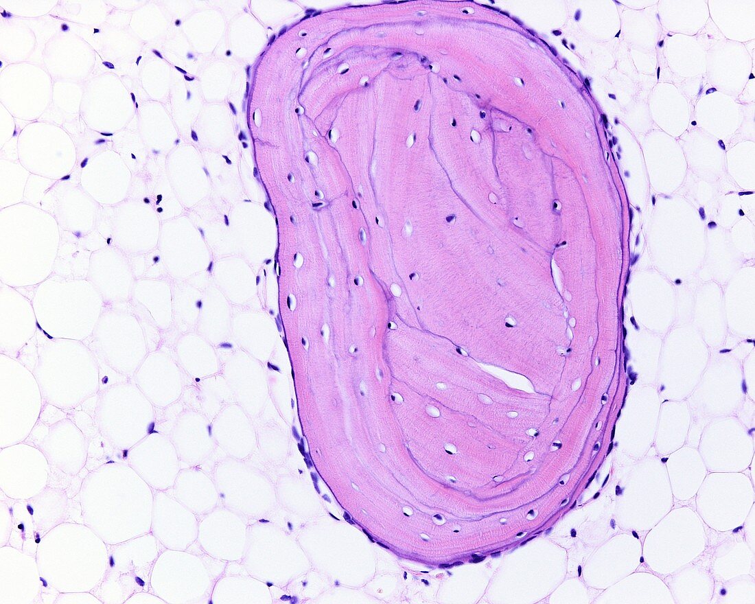 Cancellous bone trabecula, light micrograph
