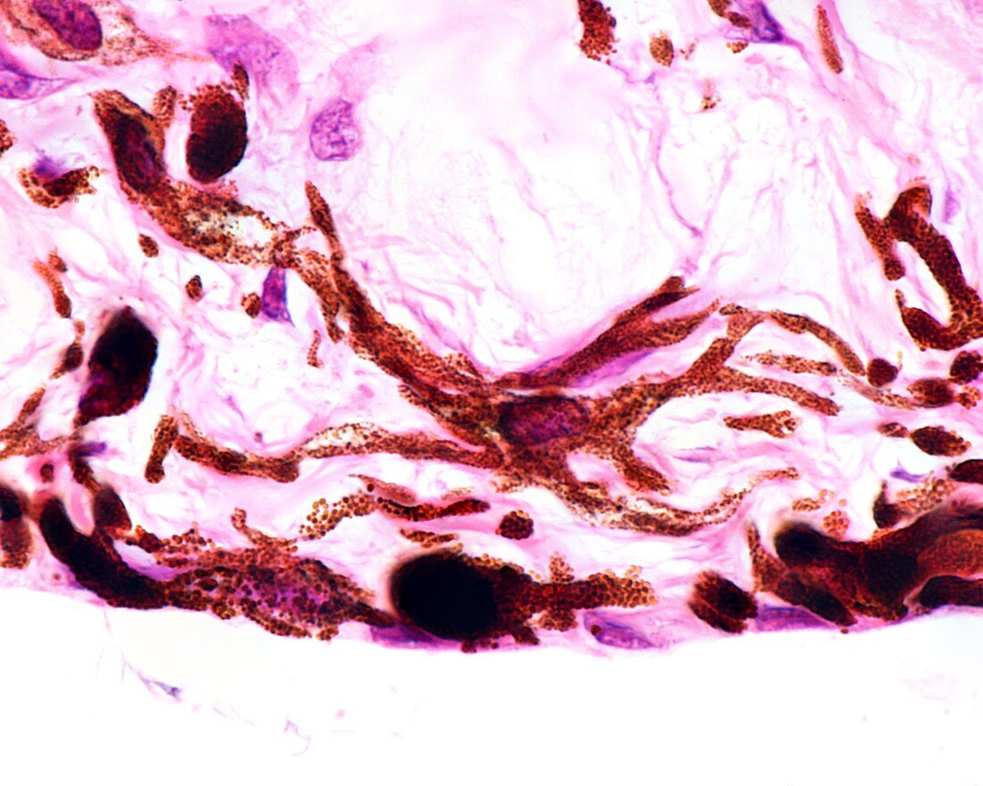 Iris pigment cells, light micrograph