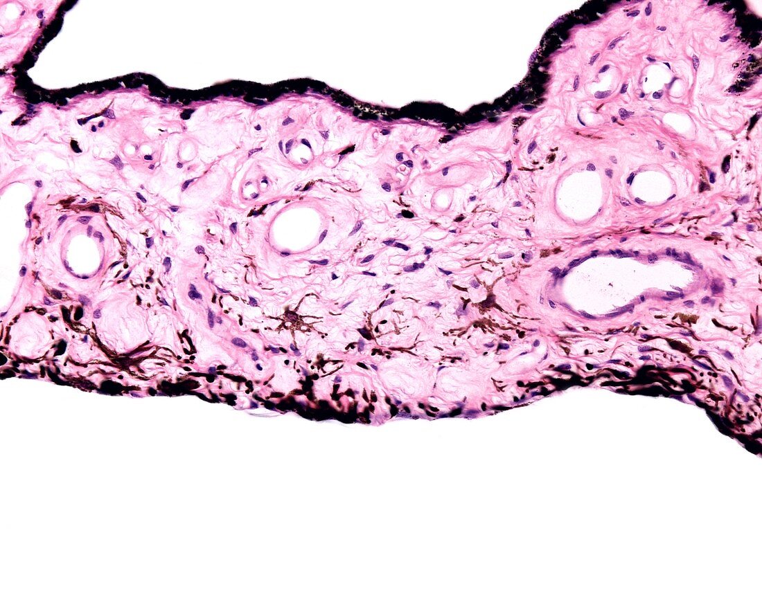 Iris layers, light micrograph