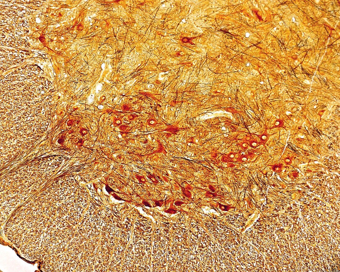 Motor neurons in spinal cord, light micrograph