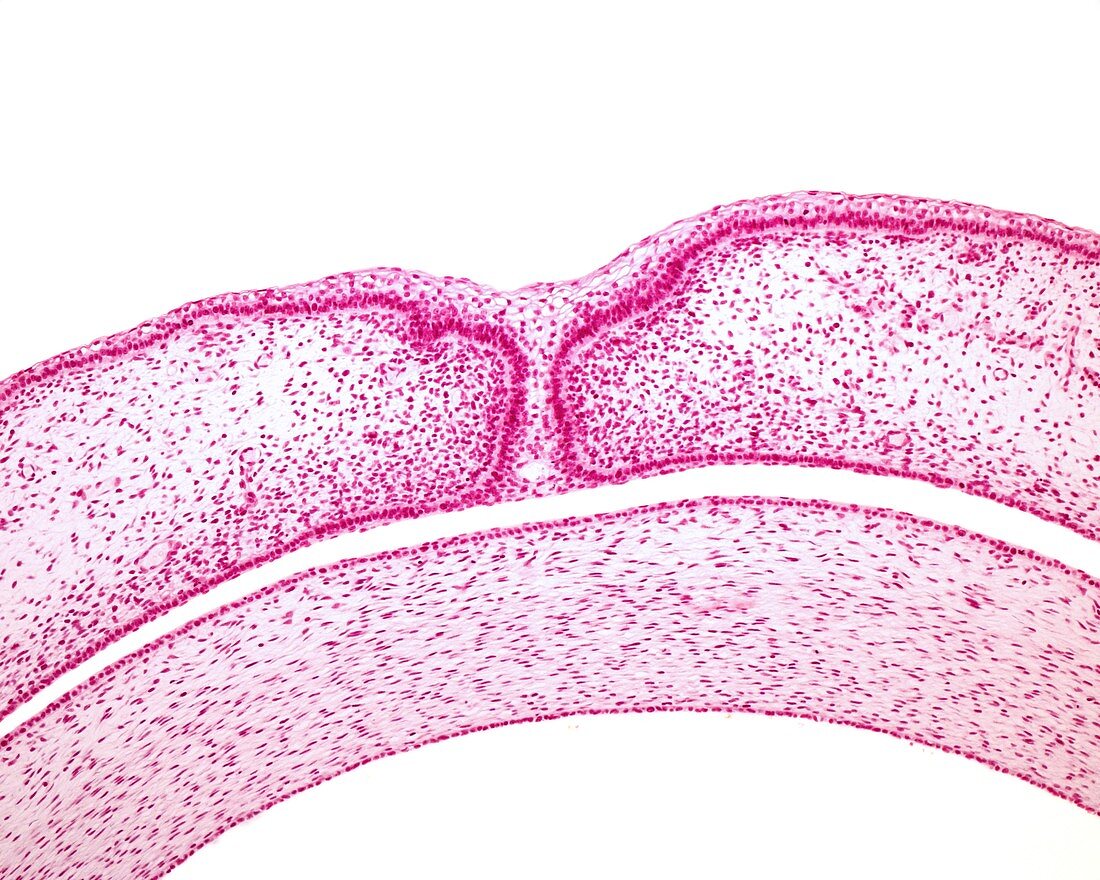 Embryonic fused eyelids, light micrograph