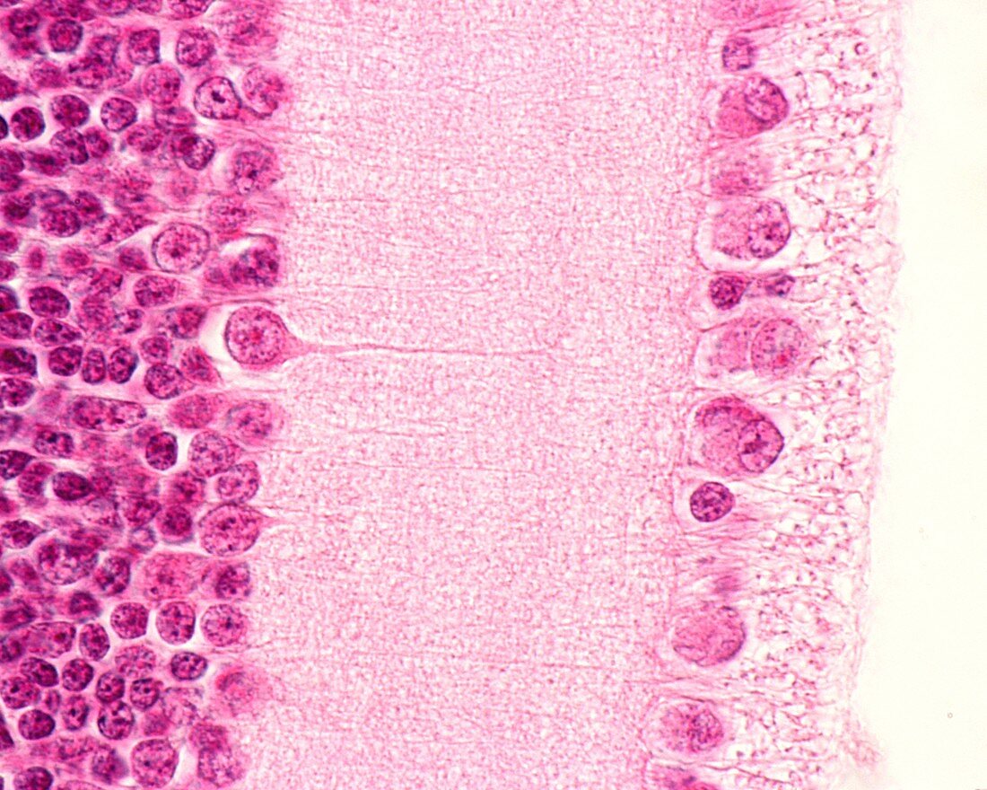 Inner layers of the retina, light micrograph