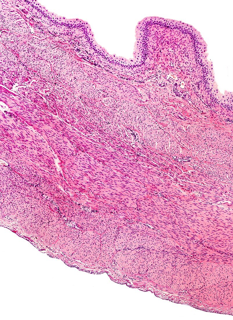 Urinary bladder wall, light micrograph