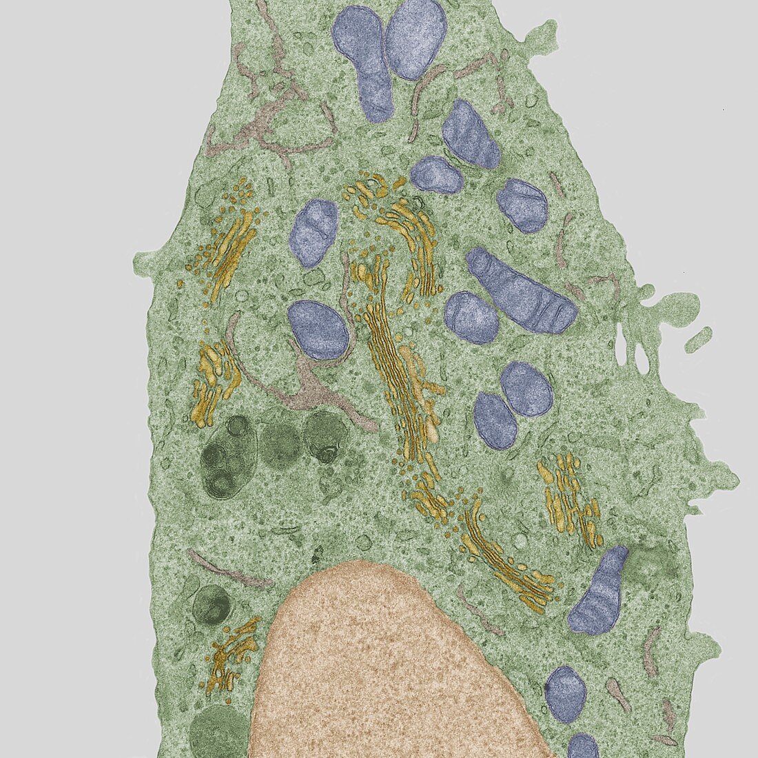 Mammalian cell, TEM