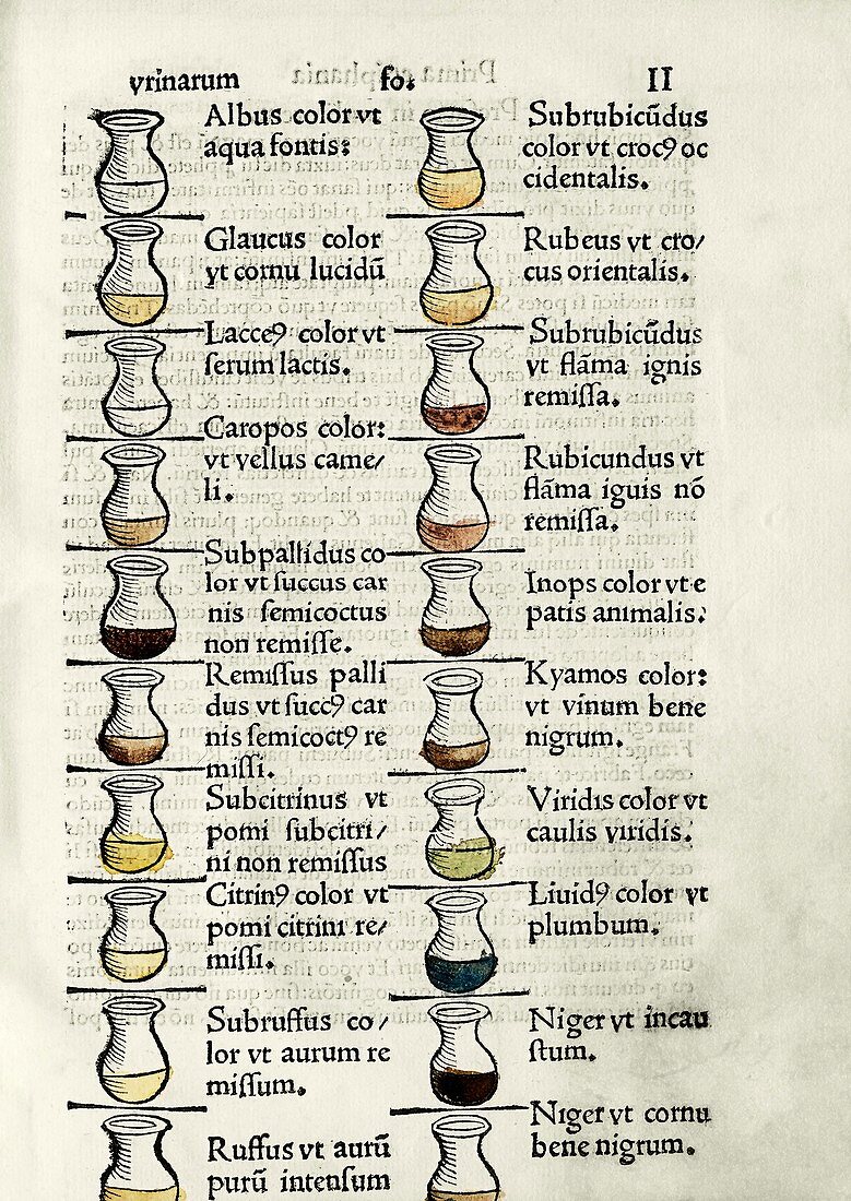 Urine analysis chart, 16th century