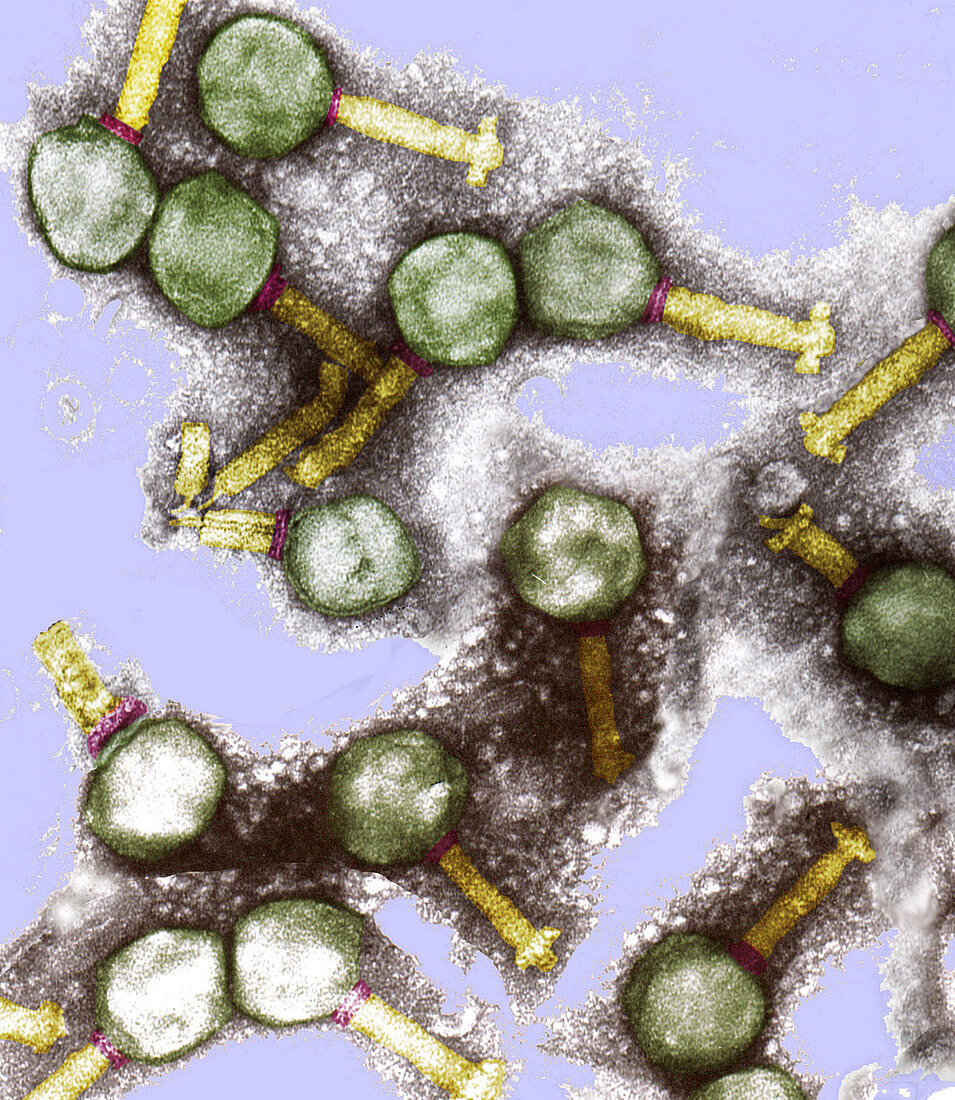 Bacteriophages infecting bacteria, TEM