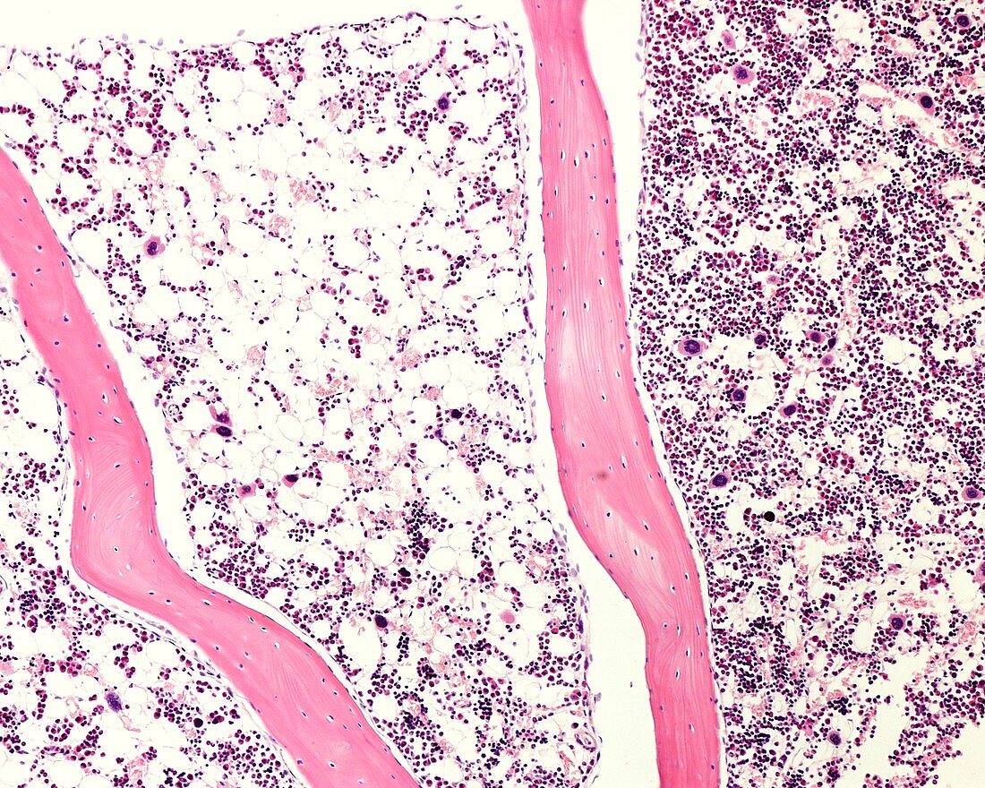 Red and yellow bone marrow, light micrograph